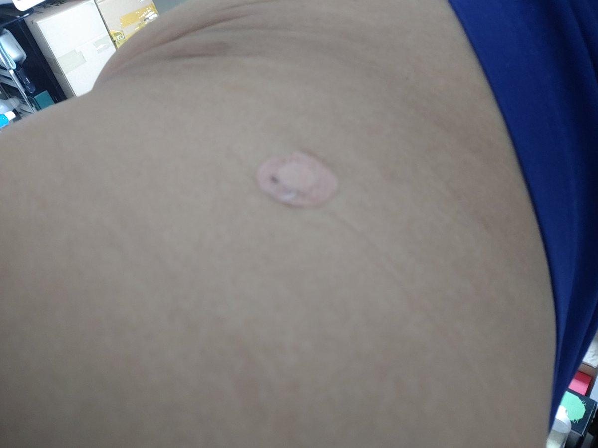 엉덩이 주사
#감기