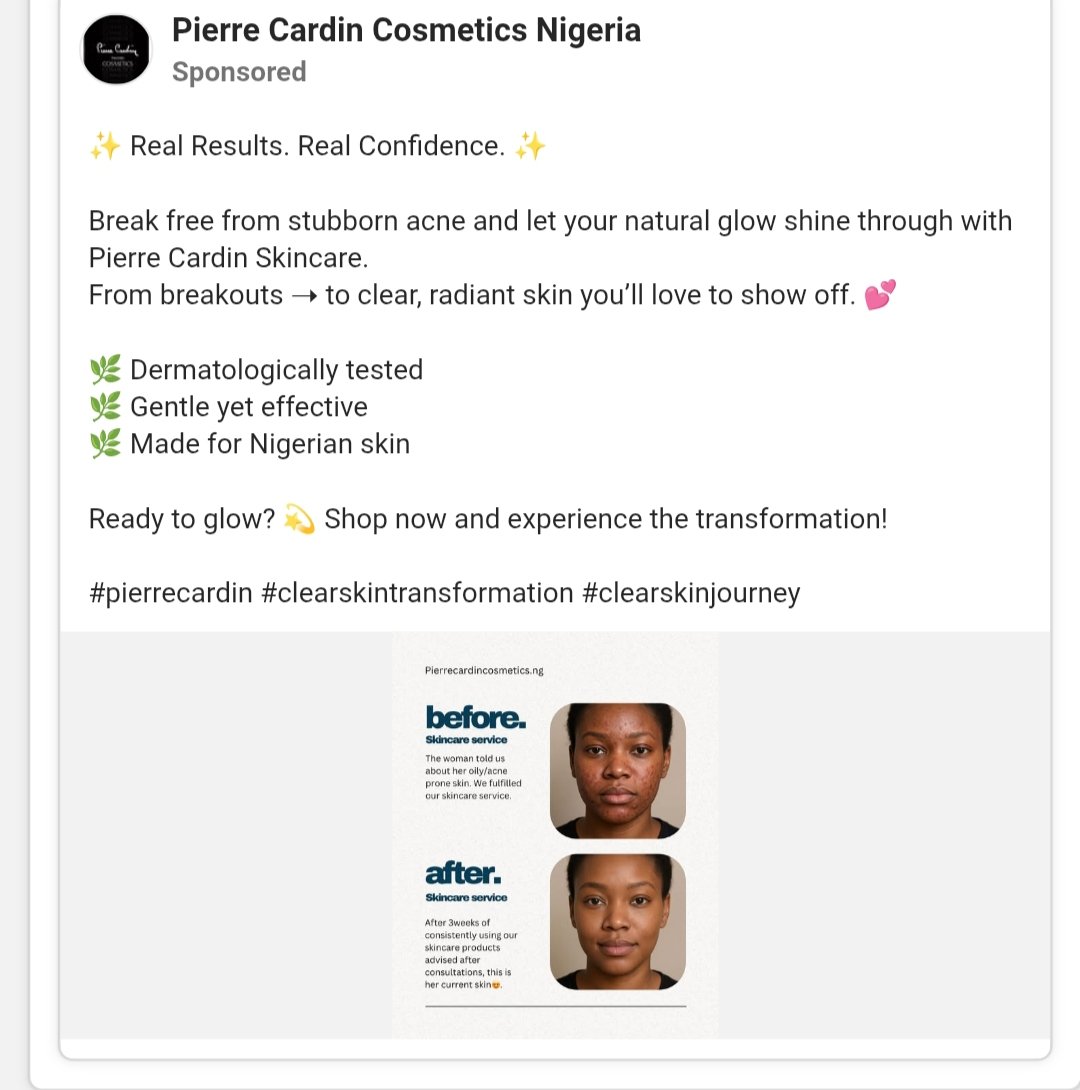 timzjnr's tweet image. Day 1 🙂‍↔️😊.
Rate my work out of 10
Before( first image), After (second image)
#copywriting #copywritingchallenge #30dayscopywritingchallenge #freelance #freelancers #skincare