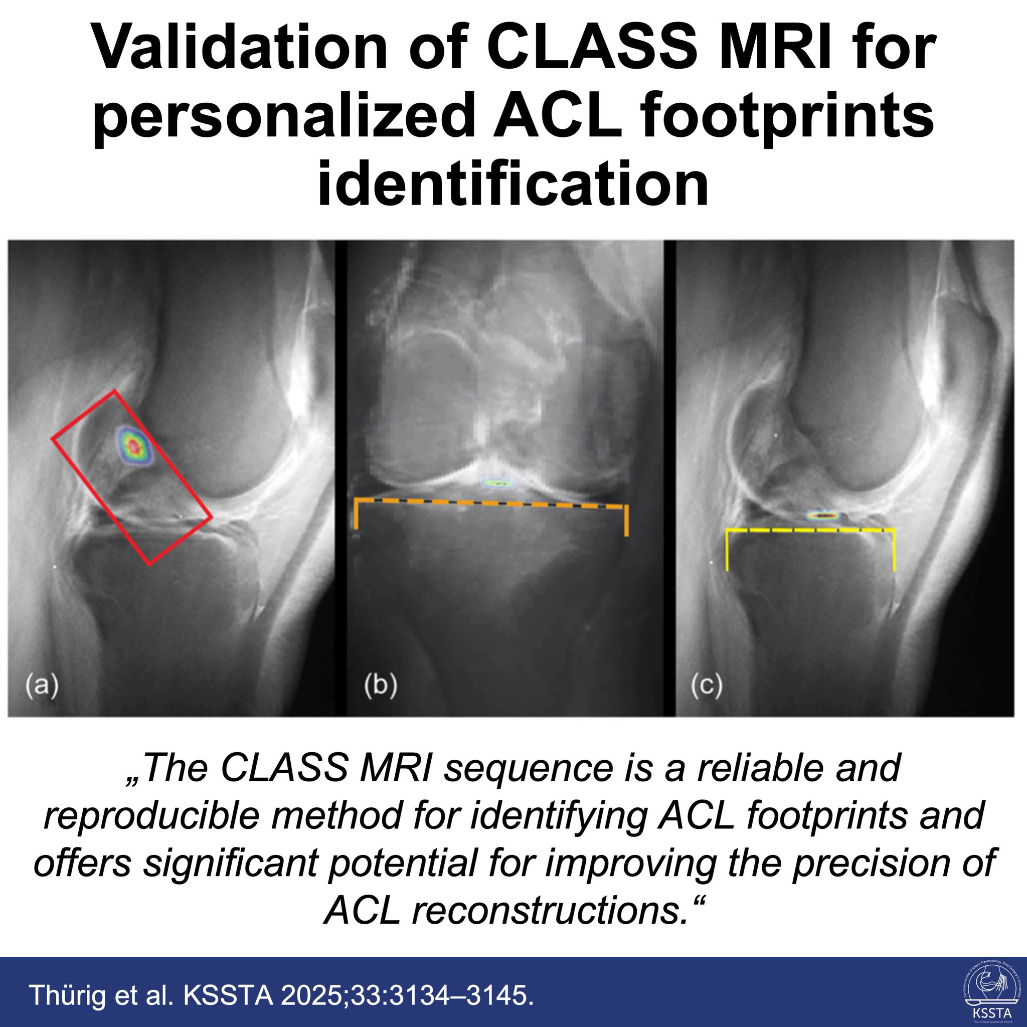 Knee Surgery, Sports Traumatology, Arthroscopy on X: 