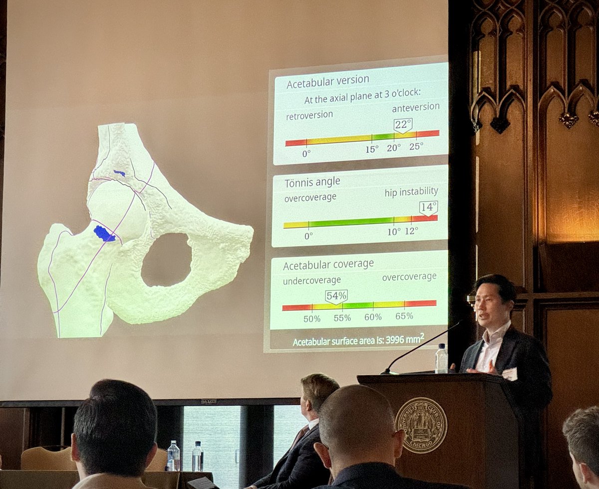Had a great time speaking at the Chicago Hip Summit and connecting with leaders in #hippreservation. Awesome conversations all around! 

#HipSurgery #HipSummit #Dysplasia #HipDysplasia