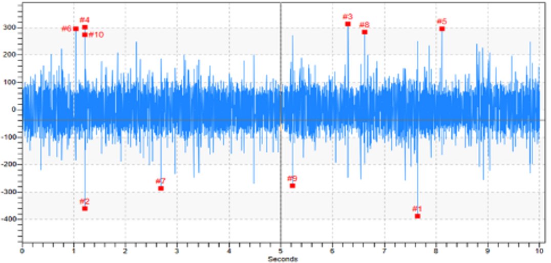 Detecting #PumpCavitation doesn’t have to be complicated.

Using ultrasound on the pump volute, we captured early-stage cavitation—hundreds of bubble implosions visible in the waveform. 

Learn more here: linkedin.com/pulse/preventi…
#Maintenance #Reliability