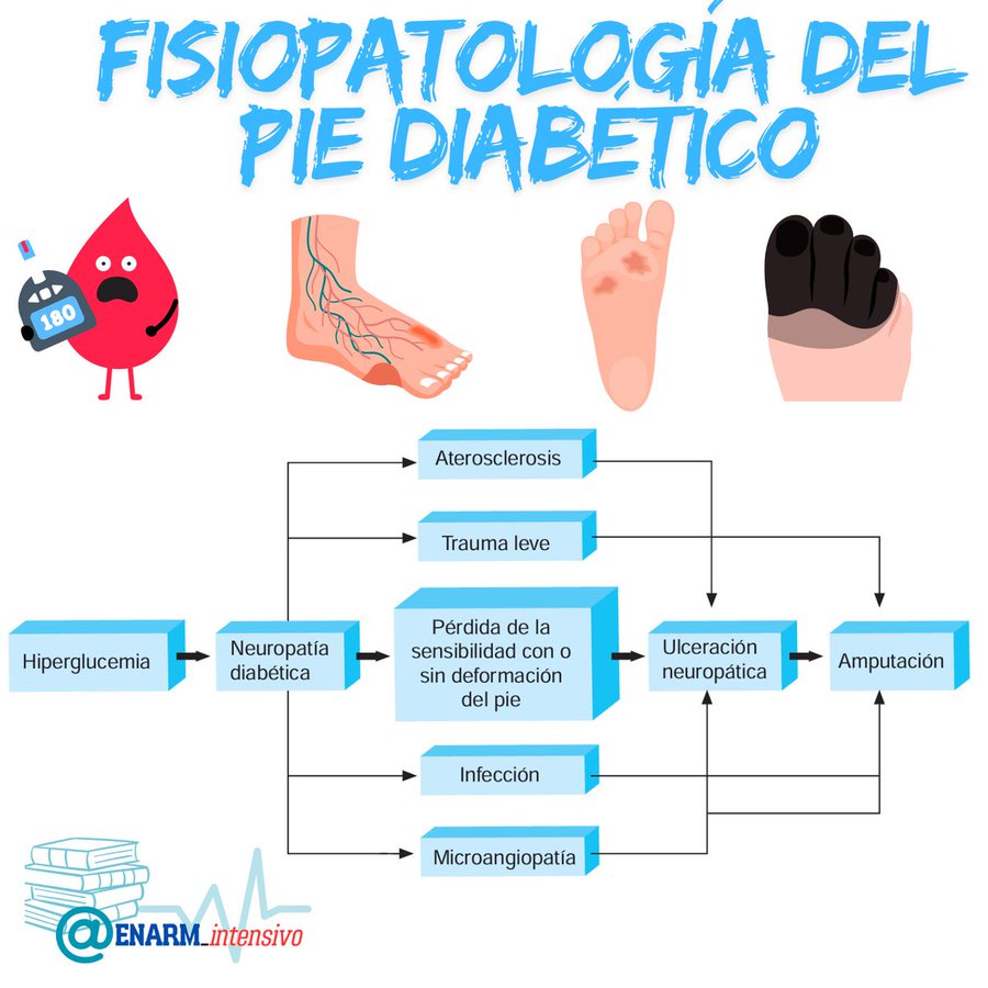 💢FISIOPATOLOGÍA  DEL  PIE  DIABÉTICO

#ENARM_INTENSIVO #ESTUDIA_MEDICINA