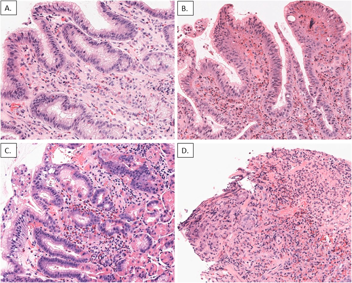 Human Pathology tweet media