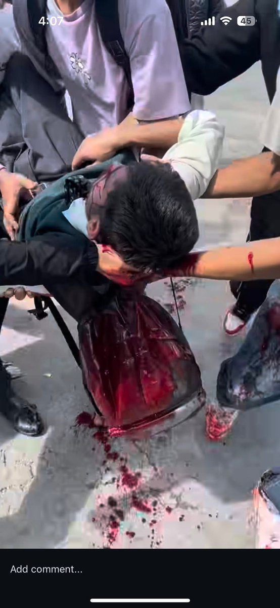 PratikMeroNaam's tweet photo. If this doesn't shakes up the people of nepal and still wait for some fu*king election then I'm sorry nothing can change the fate of this nation 🙏 

I am getting goosebumps constantly just imagining about the fact that government killed 20+ students..(1/2)
#BloodforBlood
#Nepal https://t.co/0hXkIkGrPS