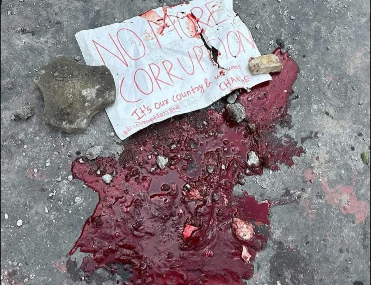 When youth rise against corruption &amp; injustice, they deserve to be heard—not shot.

In Nepal today, a student in uniform was reportedly shot in the head during #GenZProtest.

This is about the future of an entire generation.

#NepalProtests #StopCorruption #StandWithNepal