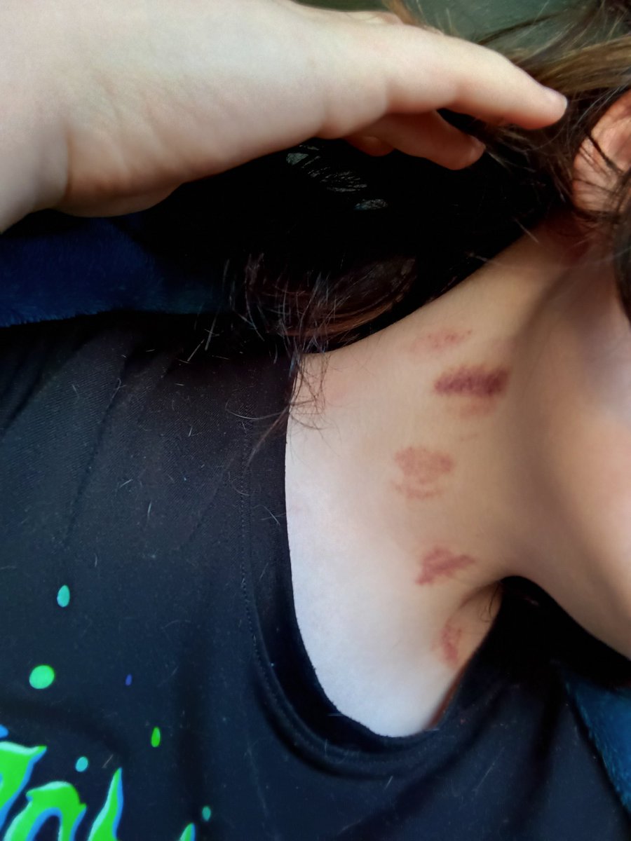 YourLilBuni's tweet photo. I wonder why my neck is sore today https://t.co/rY1CG1bzbi