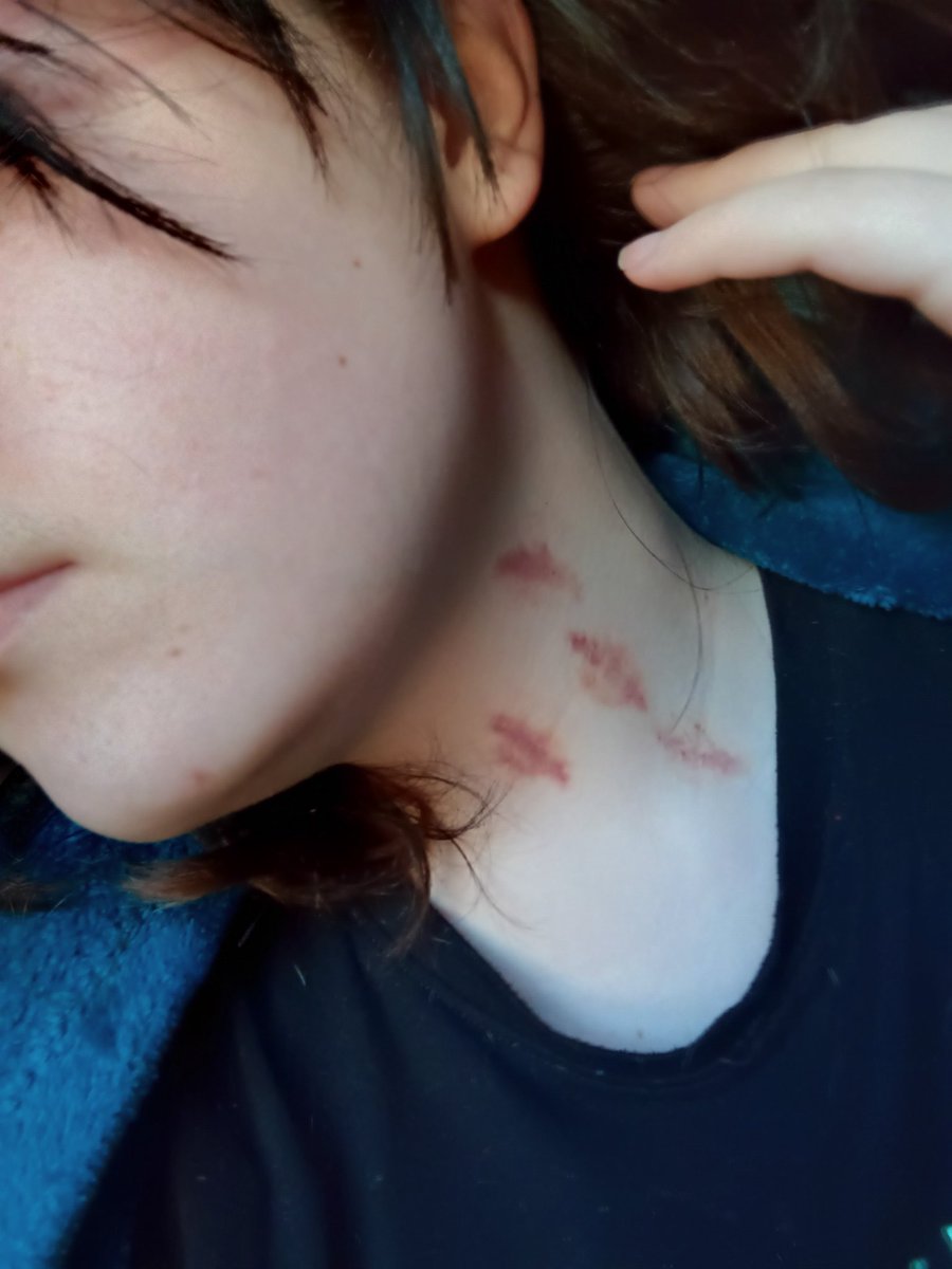 YourLilBuni's tweet photo. I wonder why my neck is sore today https://t.co/rY1CG1bzbi