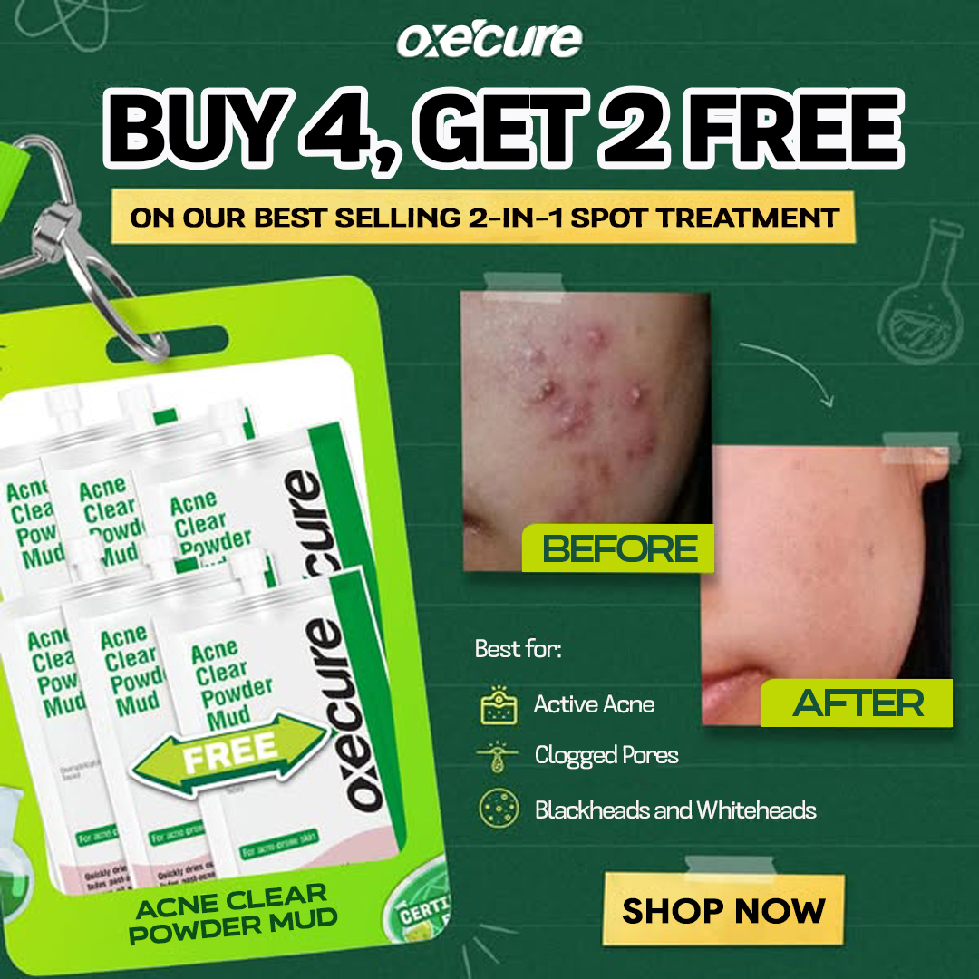 Over 8 MILLION UNITS SOLD nationwide 🏆

Fights breakouts in 6 hrs &amp; fades marks in 7 days 💥 Meet your acne-mergency: Powder Mud!

Order at: oxecureqatar.com or WhatsApp 3034-6932.