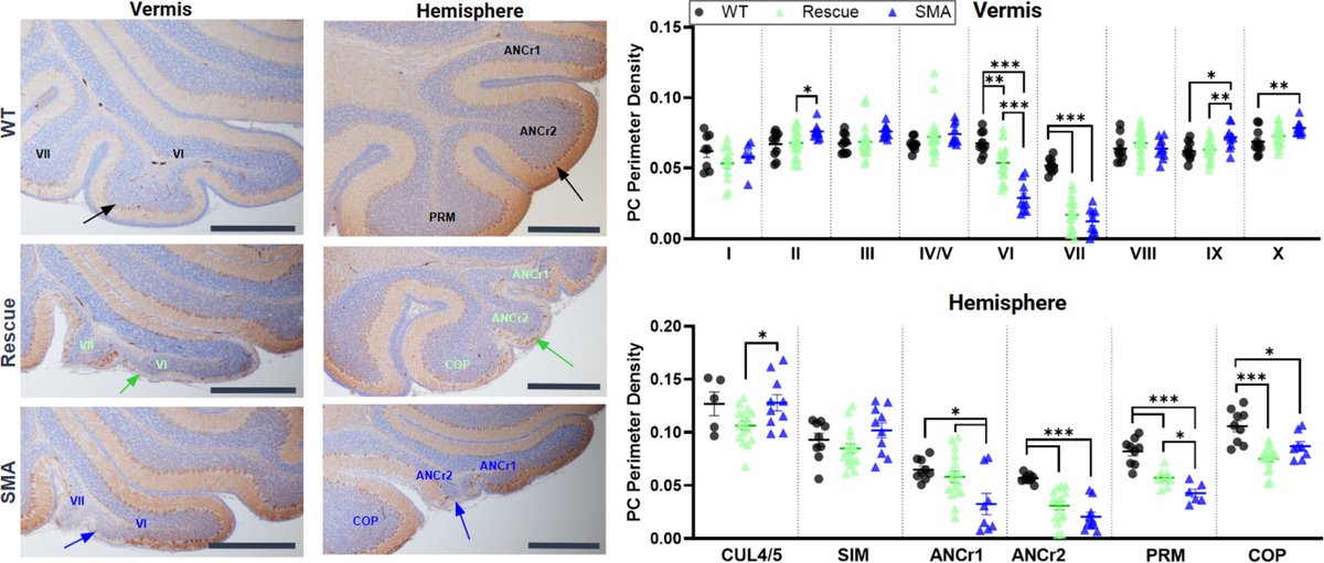 brainpathol's tweet image. Cerebellar defects are a primary pathology in mouse models of spinal muscular atrophy
onlinelibrary.wiley.com/doi/10.1111/bp…
