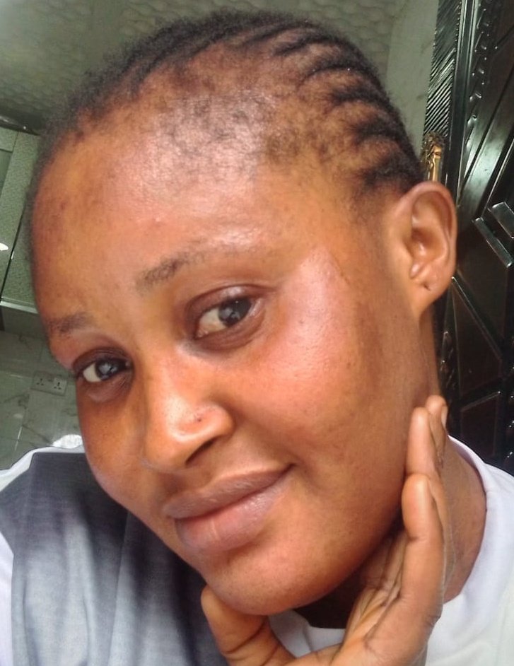 Ijawphilosopher's tweet image. Just 3 weeks After she used my anti sunburn treatment.

Abeg help Me check whether difference dey

#Esthetician #skincare