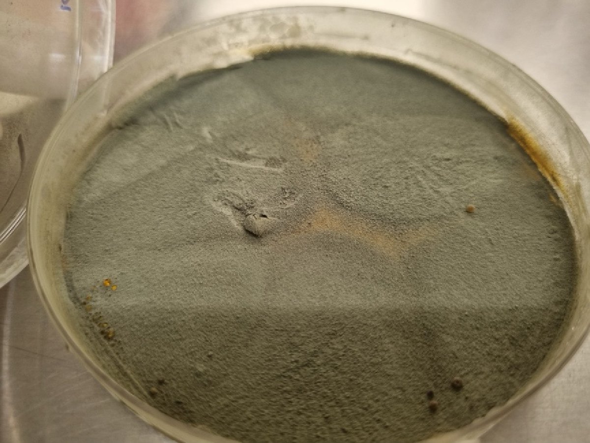 #SIF LD-Bio ICT system proves non-inferior to Aspergillus IgG ELISA and fungal culture for diagnosing chronic pulmonary aspergillosis (CPA) in post-TB patients. Higher sensitivity (75%) and specificity (92.3%) make it a good tool.
<a href="/MaximumAcademic/">Maximum Academic</a>
Details: maxapress.com/article/doi/10…