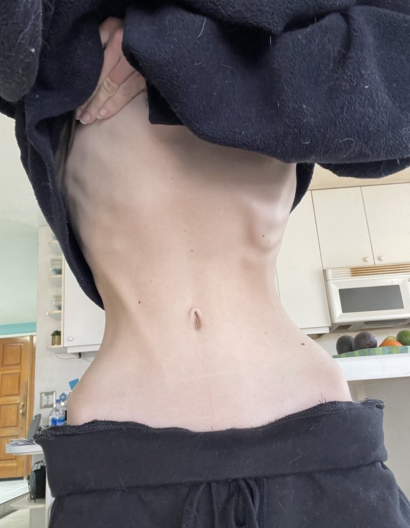 Yuki of edtwt | ˚ʚ♡ɞ˚ tweet media