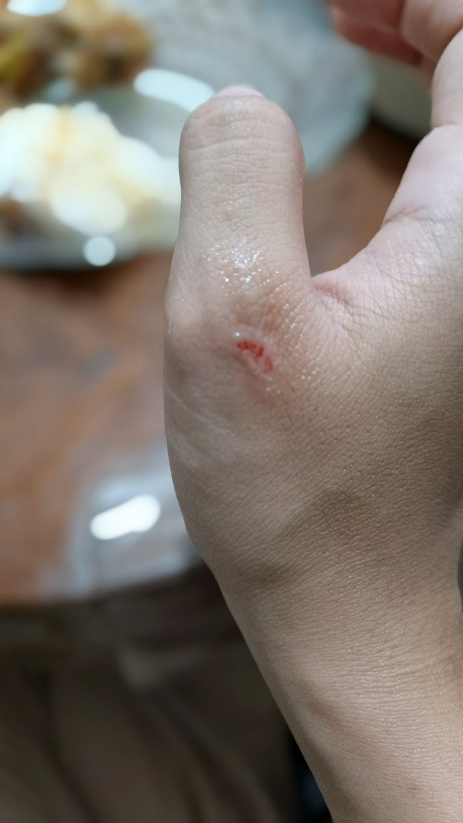 Luka setitik yang terlihat merasa kesakitan
Luka besar yang tak terlihat, kok biasa saja?