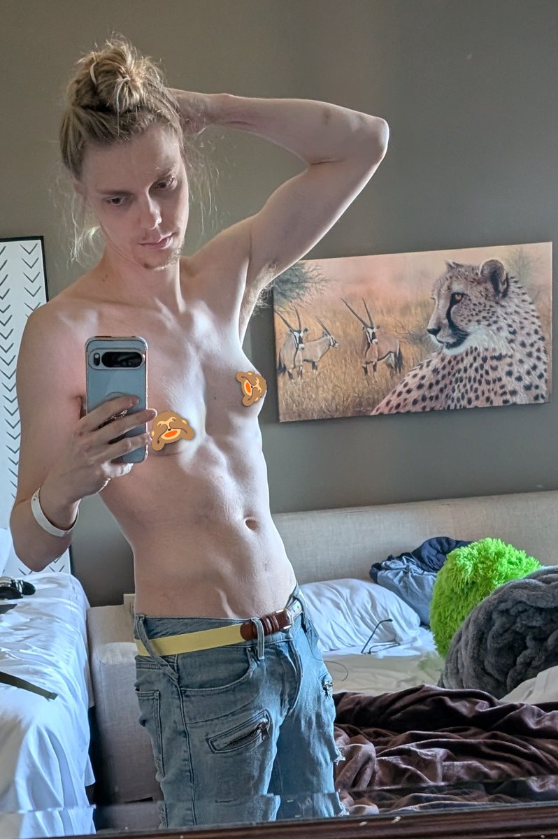 ssbmWoley's tweet photo. 2 years no blockers https://t.co/R4OqTe36BZ