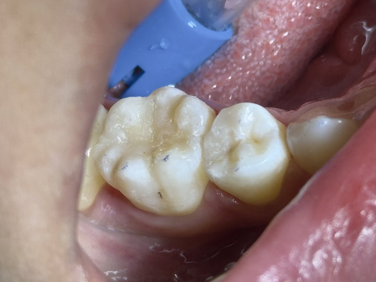 ساعد الغامدي tweet media