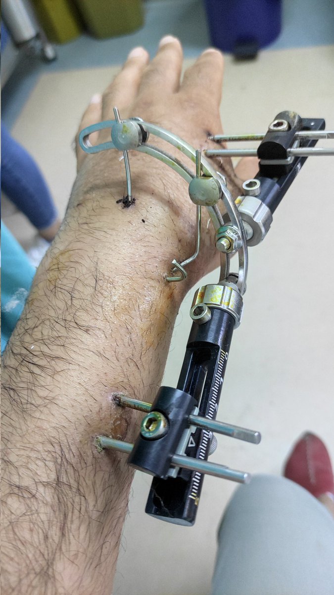 Ersin Çiloĝlu (@ersinciloglu6) on Twitter photo 