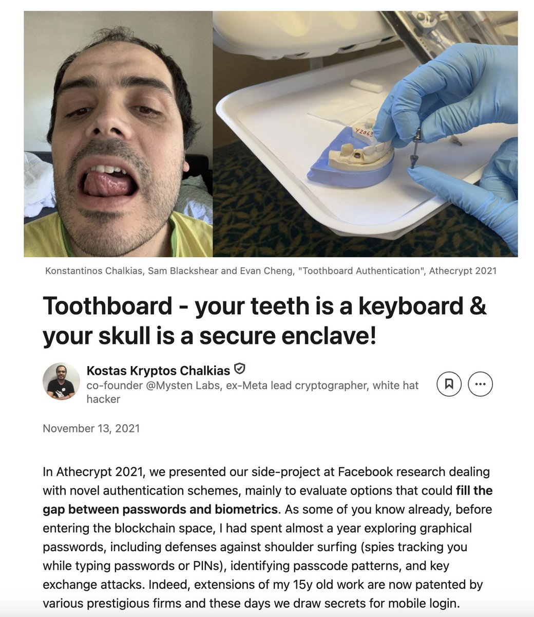 kostascrypto's tweet image. Farewell, Toothboard, only 3 people ever tried the bulky V1 in Palo Alto, and I’m the last to pull the plug.

Started with a Silicon Valley dentist + research crew in my Facebook-era days that embedded a smart sensor in my tooth. Ending today 1:30pm in a European hospital because…