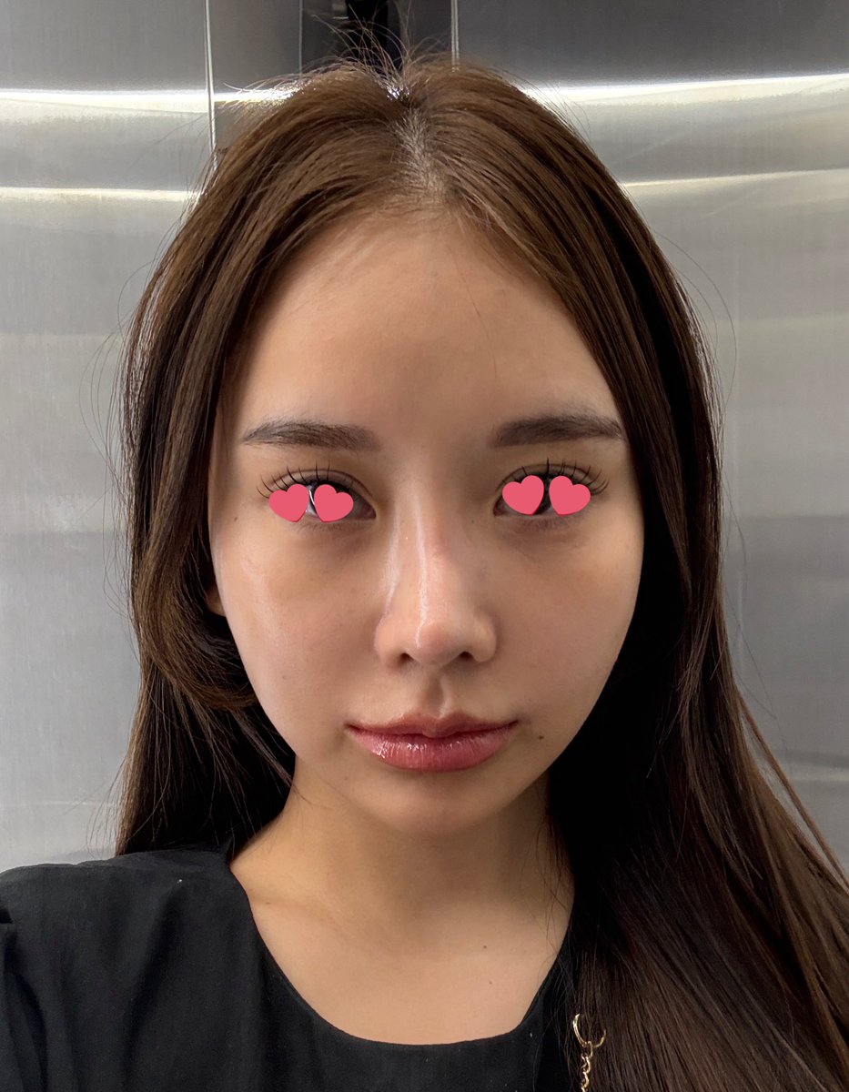 ୨୧ 𝑱𝑰𝑾𝑶𝑶 ⋆ ✿ ⋆韓国整形 ໒꒱· ﾟ (@jyuudayo) / Posts / X