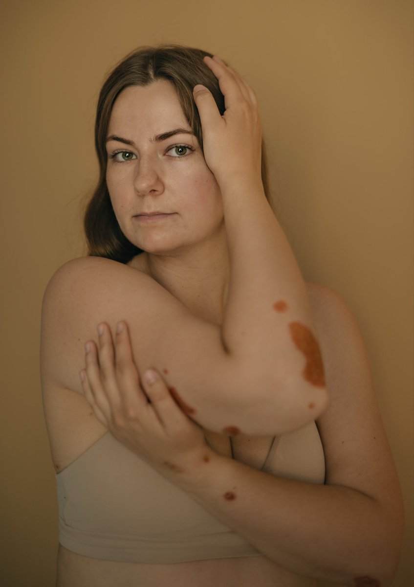 Lars Fogt Werner tweet media