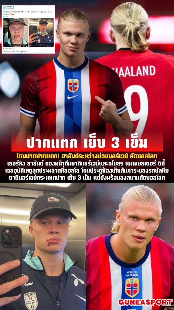 โดนฟาดปากแตก! ฮาลันด์ ช้ำเย็บ 3 เข็ม ระหว่างช่วยนอร์เวย์ คัดบอลโลก!!
💬สนใจเข้ากลุ่มฟุตบอล @GUN17(มี@นำหน้า)lin.ee/WCyuo97หรือmember.login911v2.com/register?s=zha…
#สุกี้ตี๋น้อย #pondphuwinfanconlive #ศาลฎีกา #ทักษิณชินวัตร #NottinghamForest #football  #ทักษิณ #ManCity #Haaland