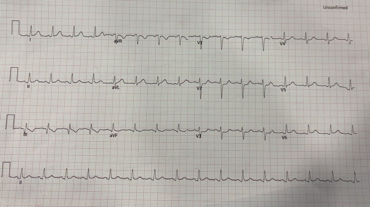 ECGs tweet media