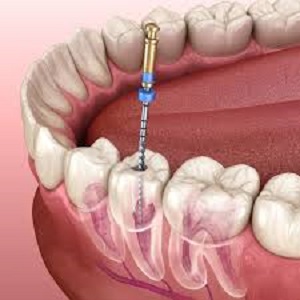 SteaveDevish's tweet photo. ✅ Advanced Technology
 ✅ Comfortable Care
 ✅ Trusted by Oakville Families
Book your appointment today and take the first step toward Call us now or visit our website to schedule.
https://t.co/nyx72nu0dB
#OakvilleDentalStudio #RootCanalTreatment #HealthySmile #OakvilleDentist https://t.co/w7Ftwg0GWZ