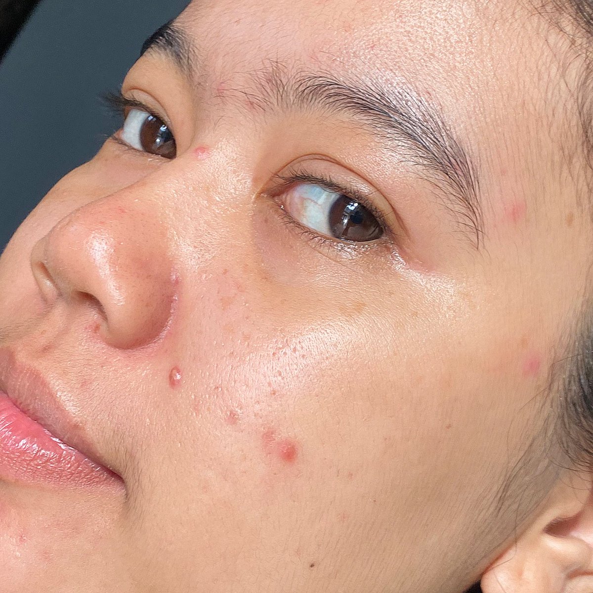 wnisekai's tweet image. finish-nya glowy skin terasa nyaman, gak bikin sumuk &amp;amp; bikin kulit terasa 'empuk' 👍 tenang, walaupun ini skincare Korea tapi sudah BPOM approved yah 

6+1+1 advanced formula:
✅ niacinamide 5%
✅ squalane
✅ sea buckthorn extract

#glowskin #axisyglowserum #axisyindonesia