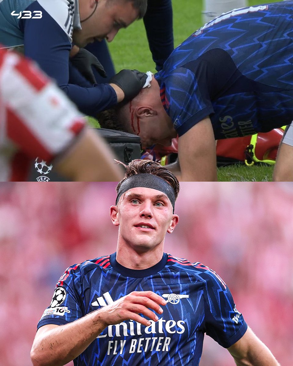 𝐖𝐀𝐑𝐑𝐈𝐎𝐑 😤🤕 Gyökeres was bleeding heavily from his head