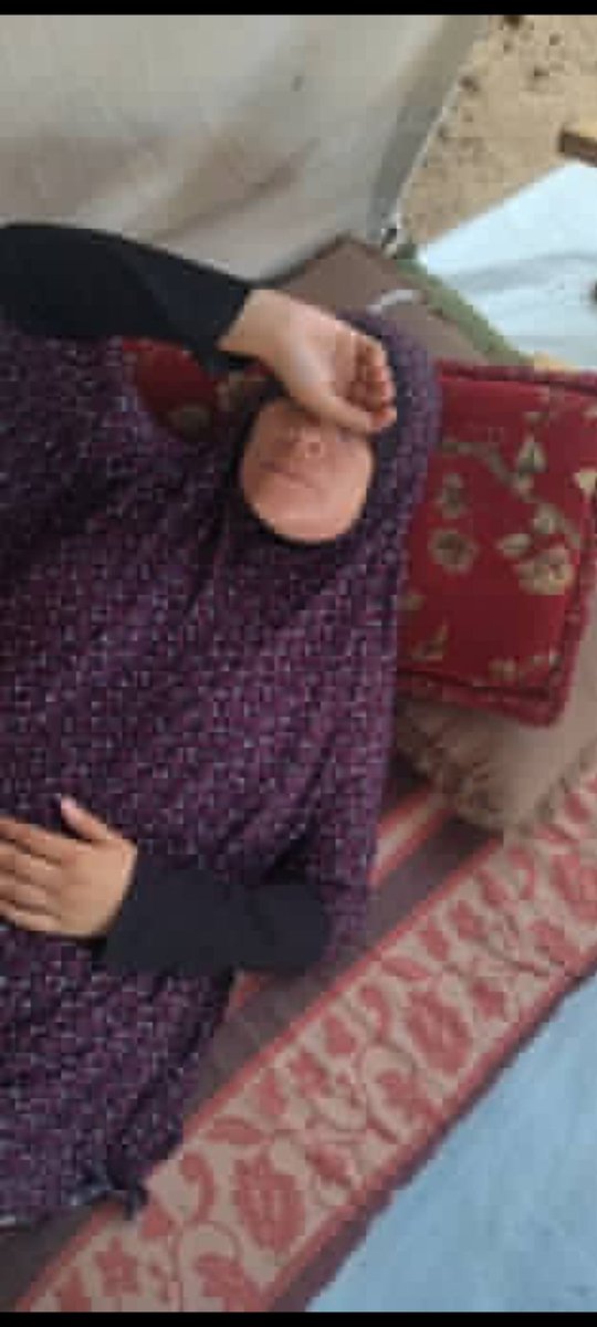 I’ve been pleading for two days to get treatment for my mom’s teeth, but I’ve only received very little. She’s in constant pain, and the treatment costs $250. Please help me afford her treatment 🙏💔
chuffed.org/project/130466
<a href="/ireallyhateyou/">B.M.</a> 
<a href="/MothTongue_/">𓂆🔻لسان العثة @gazafunds.com</a> 
<a href="/roundthefurr/">shayma</a>