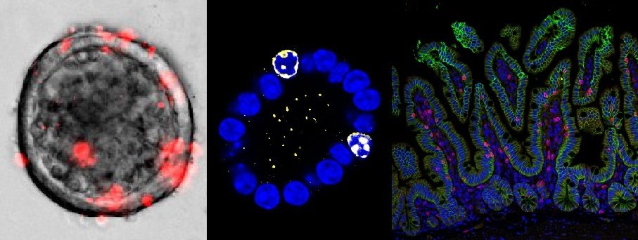 Thomas Worzfeld tweet media