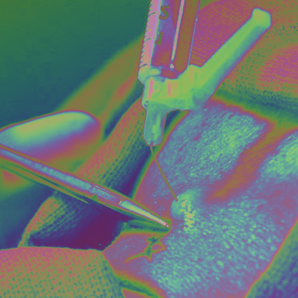 Read 'The Procedure' by the phenomenal Erin Elizabeth Williams: godscrueljokelit.com/erin-e-william…

"We see hundreds of women in every day for this. It’s a quick in and out. Nothing to worry about, not at all. My own daughter had it done just last year, and she’s never felt better."