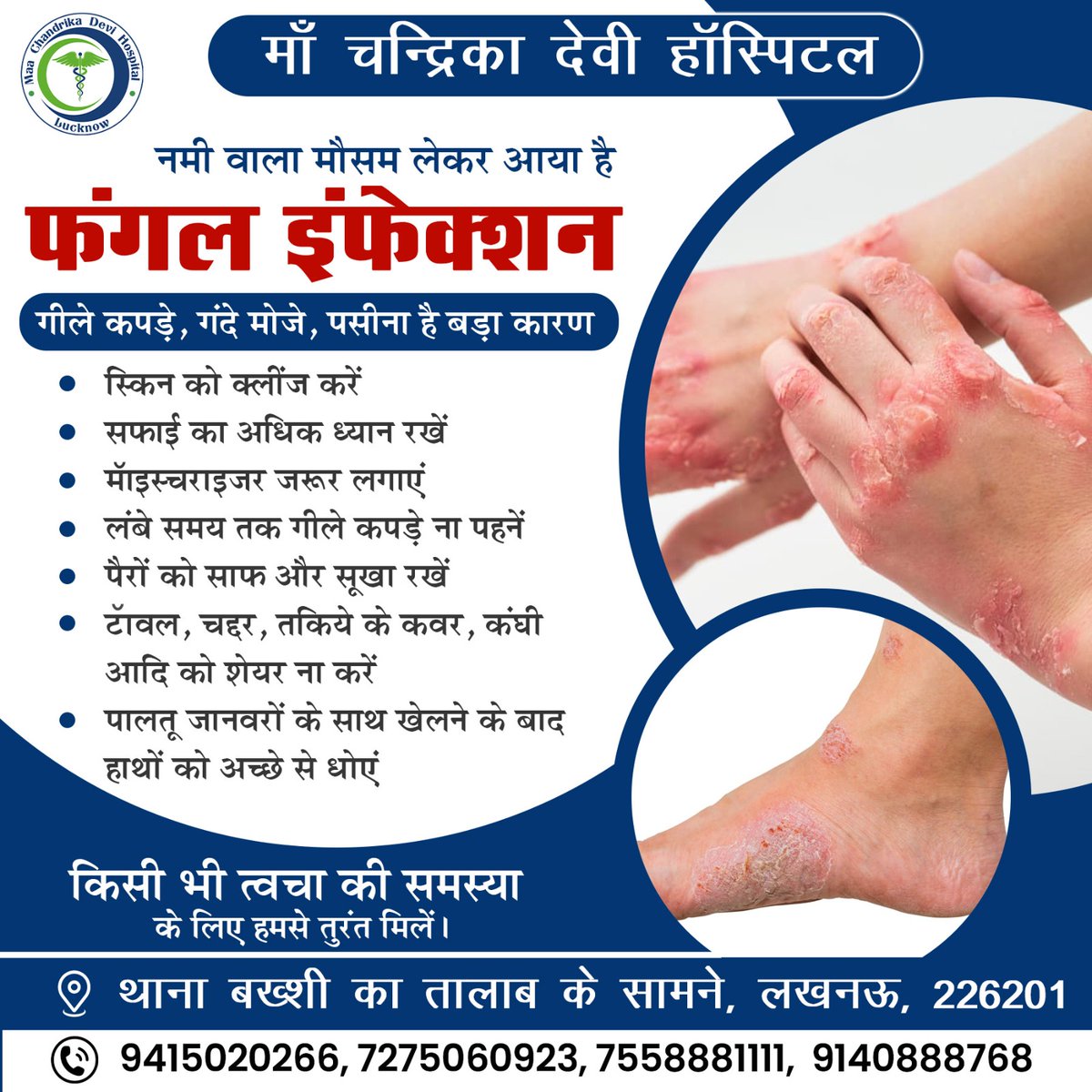 MaaDevi83419's tweet image. फंगल संक्रमण को नज़रअंदाज़ करना भारी पड़ सकता है।
अगर आपको कोई भी स्किन प्रॉब्लम हो रही है, तुरंत हमारे डॉक्टर से मिलें।

📞 अपॉइंटमेंट के लिए कॉल करें: 94150 20266, 72750 60923 या 75588 81111 पर I
#SkinCareInRain #besthospitalinlucknow #SkinDisease #SkinCare #FungalInfection