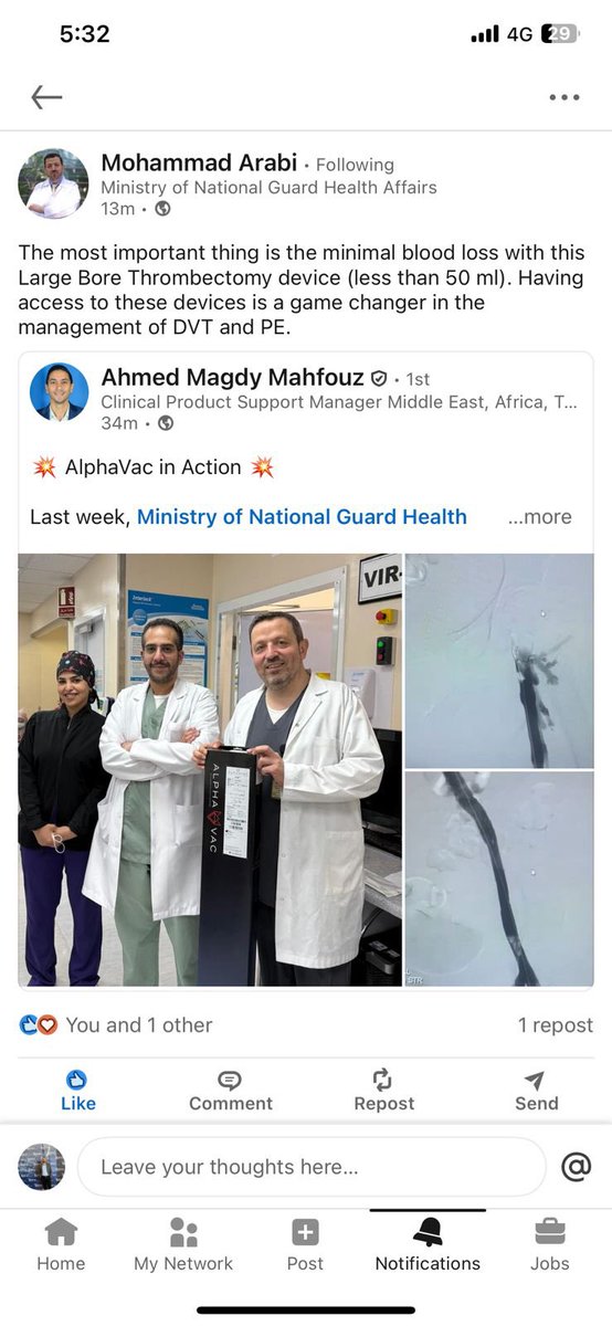 AFawzyElsayed's tweet image. 💥 #AlphaVac in Action 💥 #ATH
#ANGIODYNAMICS
#DVT #VascularMedicine #AlphaVac #PatientCare #EndovascularTherapy #InnovationInMedicine #InterventionalRadiology #VenousThrombectomy #ClotManagement #KSA #saudiarabia #interventionradiology