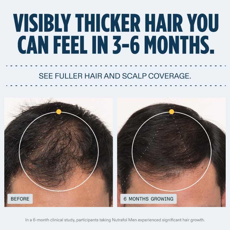 NutrafolMen's tweet photo. Clinically proven. Hands-on results. Real growth starts with Nutrafol Men.