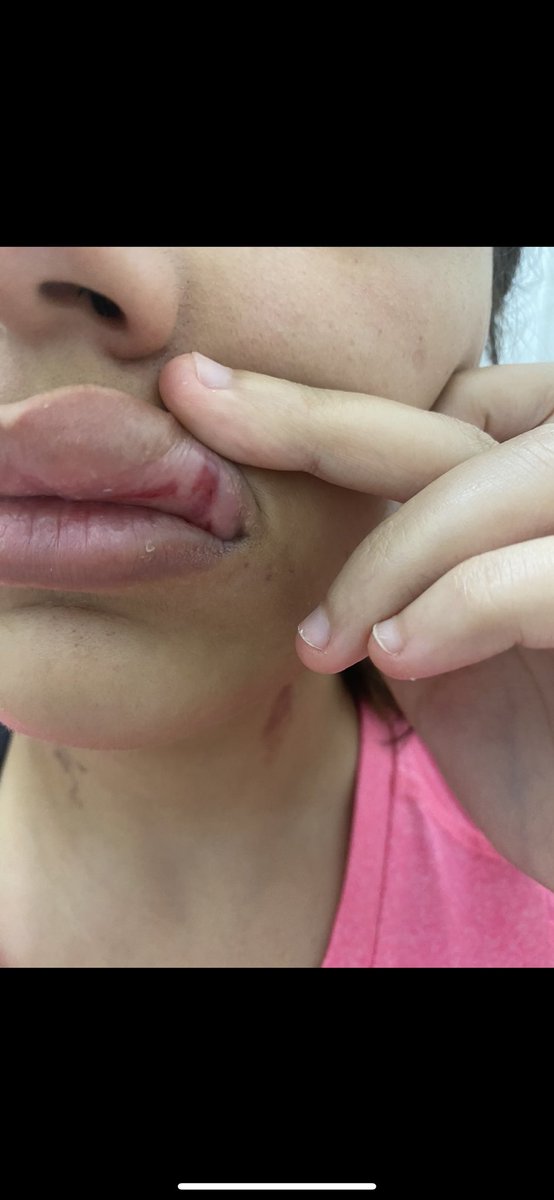 دول جزء من الريبورت الى عملته هنا ومعايا ادلة على كل حاجة مكتوبة هنا والحقايق اسوأ وابشع بكتير، حفاظا على صحتى النفسية مش قادره اشارك كل حاجة وحفاظا على خصوصيتى دول الى قادرة اشاركهم هنا