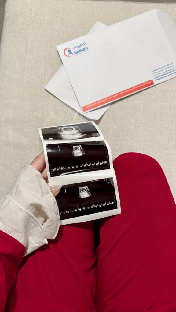 2avilli's tweet image. اللّهم سهل عليّ ماتبقى من حملي
و هون عليّ ولادتي ، وسهل لي ما أخاف منه
اللّهم تمم فرحتي، وارزقني لذة إحتضان
جنيني بصحة وعافية🤍