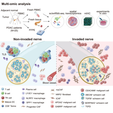 Cancer Cell (@cancer_cell) on Twitter photo Integrated single-cell and spatial transcriptomics uncover distinct cellular subtypes involved in neural invasion in pancreatic cancer dlvr.it/TMzL9K Integrated single-cell and spatial transcriptomics uncover distinct cellular subtypes involved in neural invasion in pancreatic cancer dlvr.it/TMzL9K