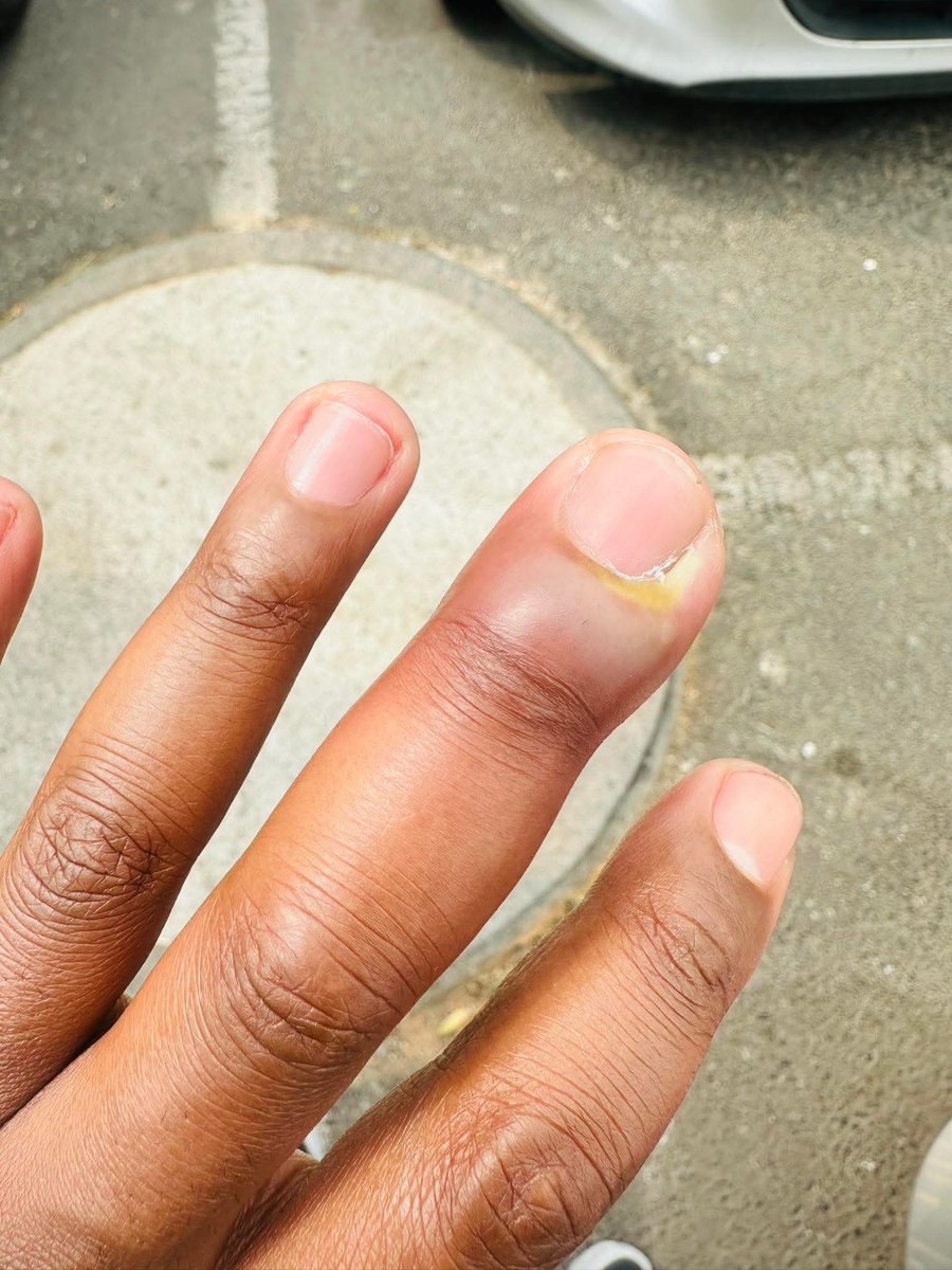 MaoengKekeletso's tweet photo. What causes this.?👀 https://t.co/hzGFMV3Nll