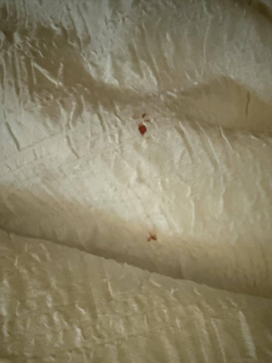 kll0014's tweet photo. @HamptonByHilton had a layover at Miami Airport East. After a long day I jump into bed to find bloody comforter and sheets. I asked that someone contact me by yesterday to discuss -no response from hotel. I need resolution. I chose Hampton based on prior quality https://t.co/nNpZRErZ8t