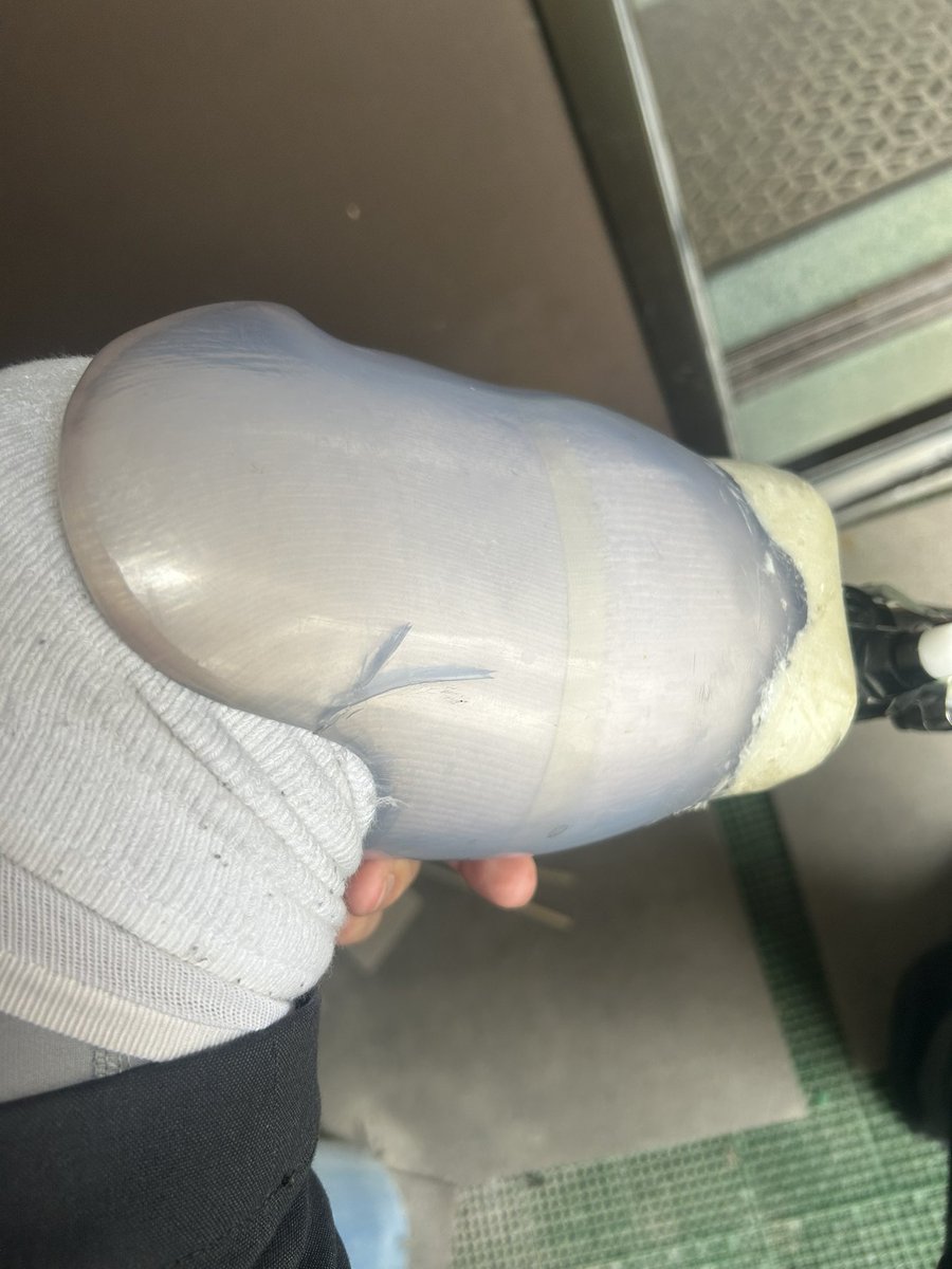 ReNoing07's tweet photo. 久しぶりに夜中腹痛にて覚醒ww寝れん
つか本義足の申請許可下りてくれマジで😰1ヶ月経過したわ
明後日技師さんと型取り予定だったけどまーたキャンセルだな。
おい新潟県よ聞いてるか？？仮義足割れ始めてるんだけどさ。申請下りたらすぐ出来ると思う？？すぐ履けると思ってるの？リハビリいるんだよ https://t.co/rTgYfe4XsR