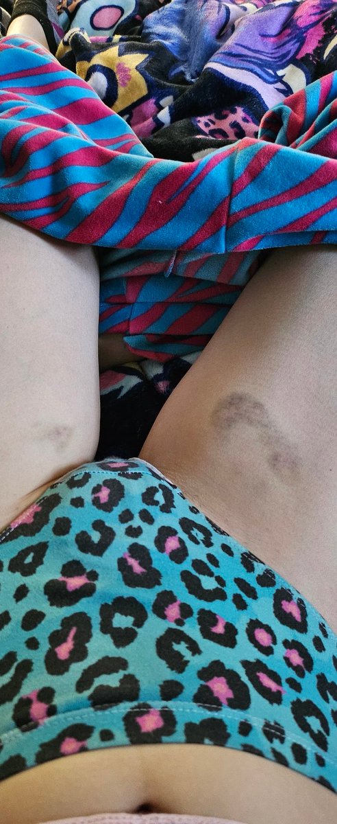 They got darker hehe 😳🥺
Thank you <a href="/InfurnoWolf/">Dead Account</a> for marking me 💕