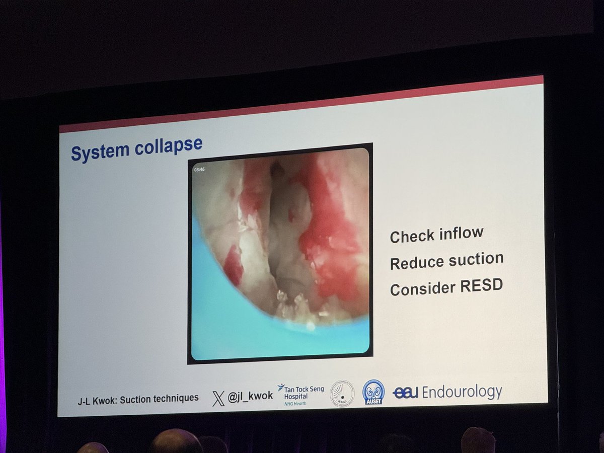 DrDAgarwal's tweet image. @jl_kwok discusses tips and tricks for ureteroscopic suction

🛑Don't advance sheath without obturator when slips out of UPJ
🫰Stabilize sheath when withdrawing fragments

see pics for more tips

@Endo_Society #WCET25