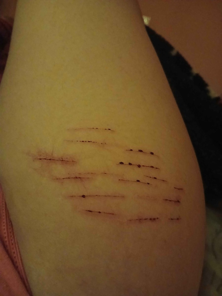Why are they so straight? Wow, what a great pulse.
