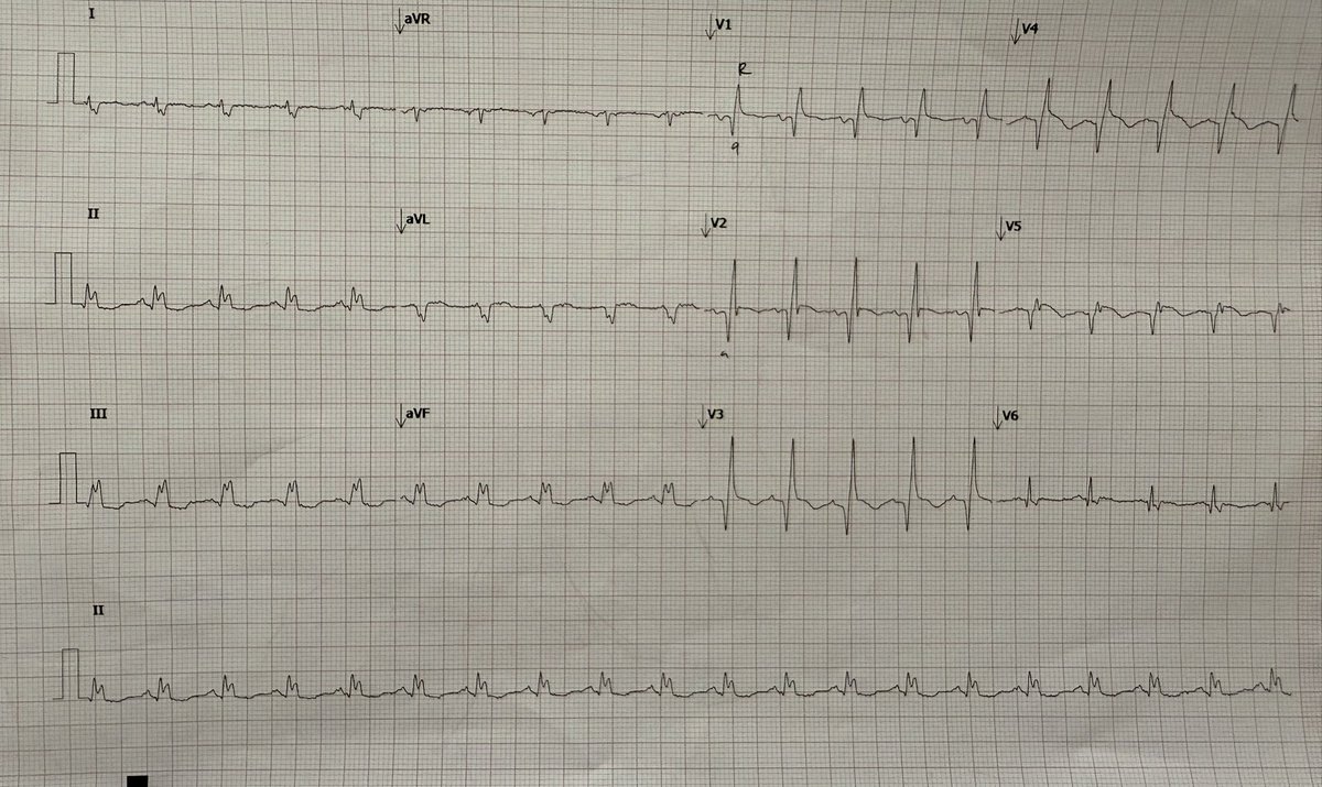 MuvennKannan tweet media