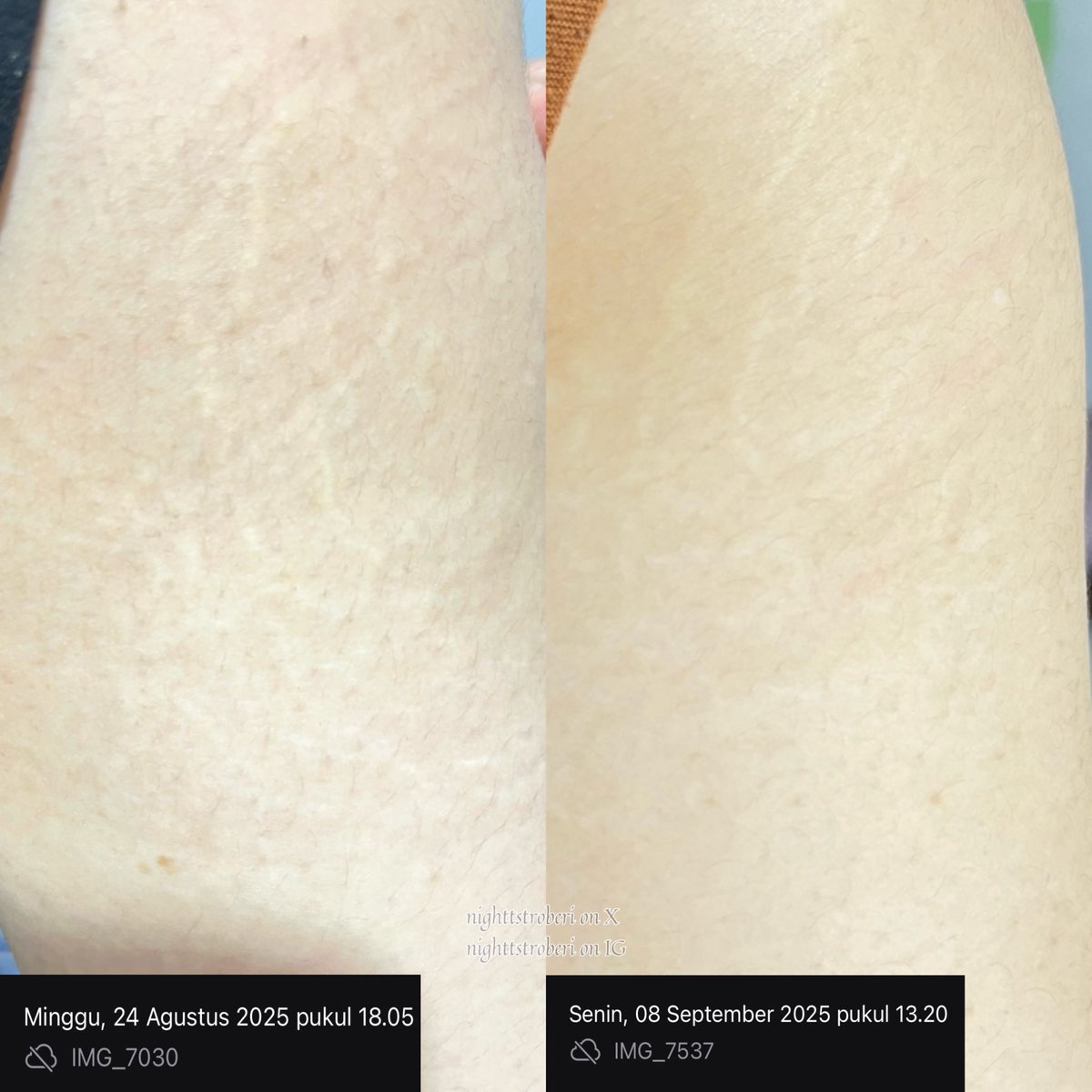 nighttstroberi's tweet photo. Rekomendasi dari aku yang punya stretch mark nih, wajib cobain produk ini 😻😻.

Stretch Mark oil yang udah dermatologically tested 🙌🏻 + aman dipakai ibu hamil 😻.

#reviewbychika https://t.co/cKwqeeB6q0