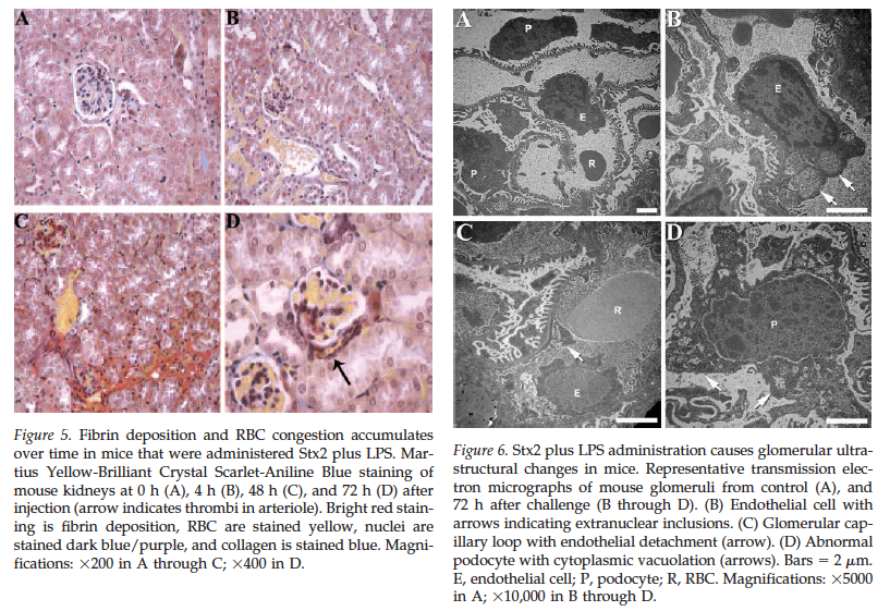 FluoridePoison's tweet image. As well as Endotoxin, Escherichia coli bacteria produce Shiga-Like Toxin that kills people by destroying their Kidneys.
How much Shiga-Like Toxin is in Jab Vials?
Shiga-Like Toxin often contains 50% by weight Endotoxin. Combo toxins kill Kidneys by Synergy
geoffpain.substack.com/p/kidney-death…