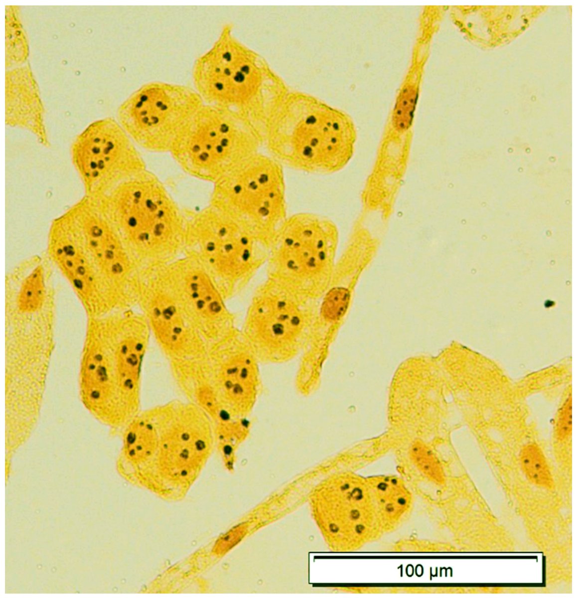 Fire_MDPI's tweet image. #firemdpi 
Impact of Fire Recurrence and Water Stress on the Root Nucleolar Activity of Maritime Pine (Pinus pinaster Ait.) Individuals Whose Seeds Were Harvested in Post-Fire Naturally Regenerated Stands
 
👉brnw.ch/21wVDkj

#cytogenetics #interphase