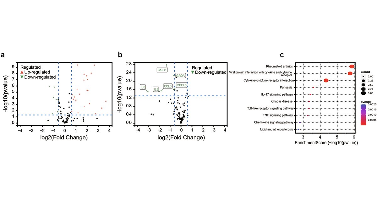 sigtrans_sttt's tweet image. In a multicenter trial, the thalidomide–prednisone–methotrexate (TPM) regimen achieved a 75% complete remission rate and 90% overall response in symptomatic #LGLL patients, highlighting TPM as a safe and effective treatment option.

#STTT #OpenAccess: doi.org/10.1038/s41392…