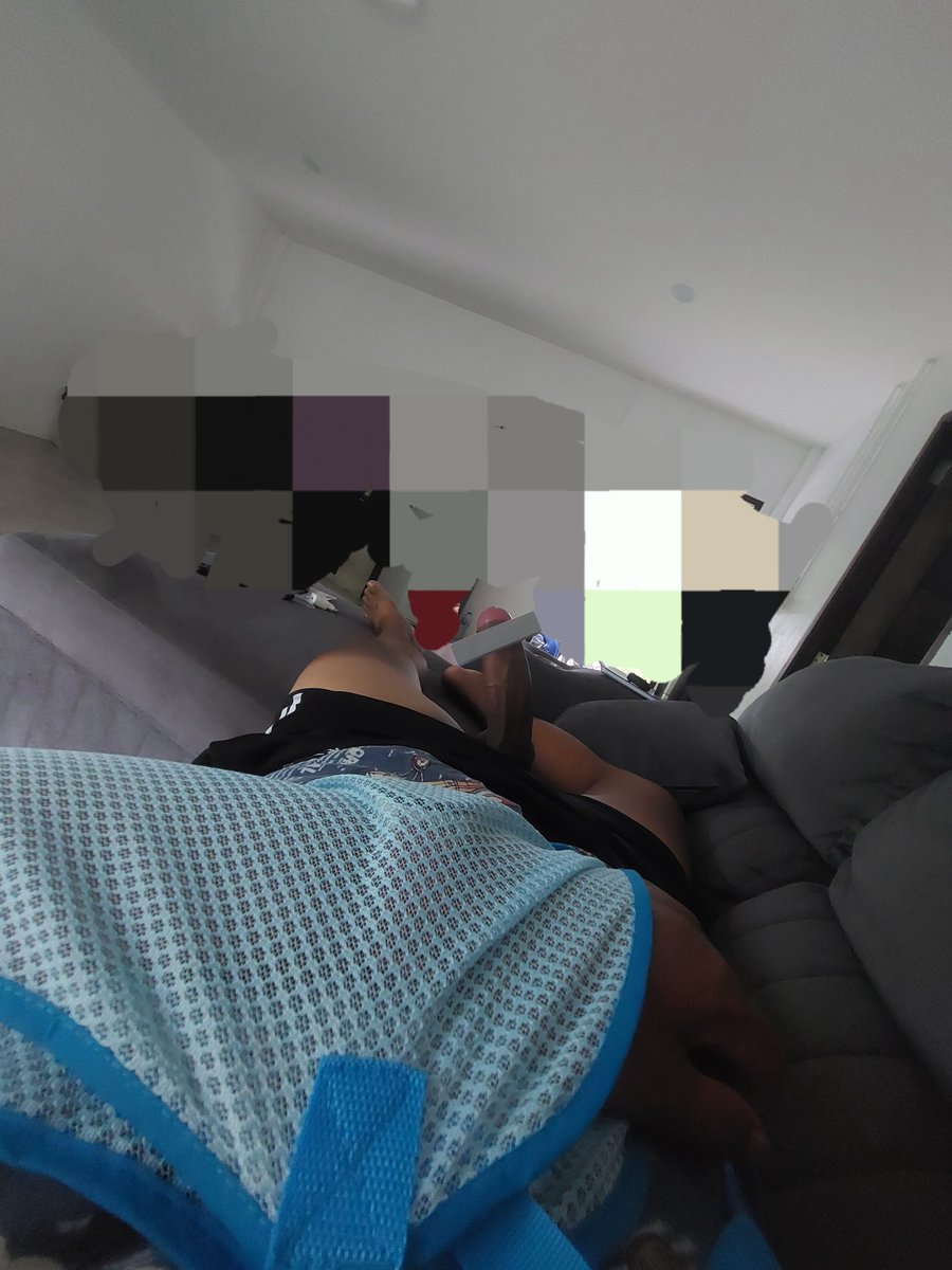 เจ็บแขน แถมเง่นอีก🍌😞