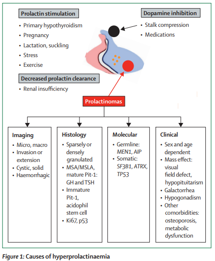 TheLancetEndo's tweet image. In the October Issue:
Prolactin-secreting adenomas: pathogenesis, diagnosis, and management thelancet.com/journals/landi… 
#prolactinomas #hyperprolactinaemia #pituitary